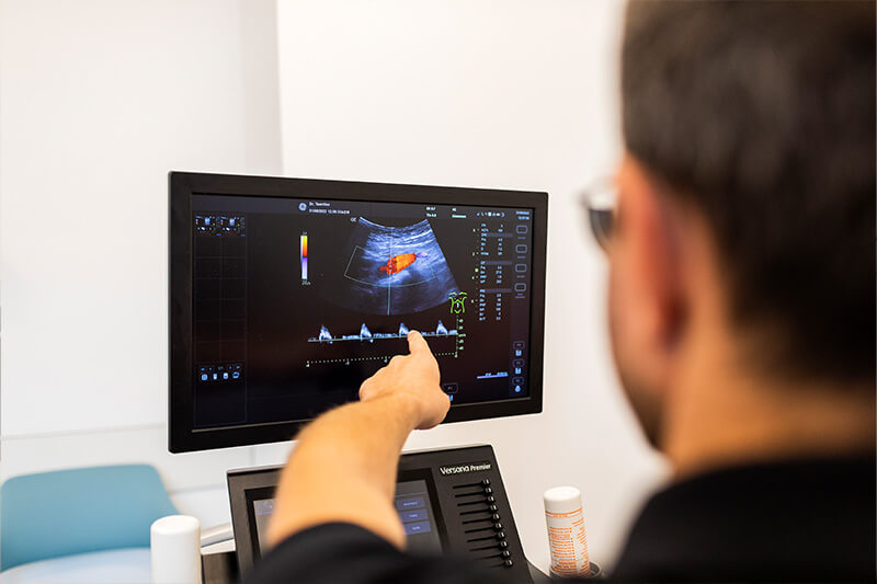 Gefaesschirurgie Tsantilas Person zeigt auf den Bildschirm eines Ultraschallgerätes