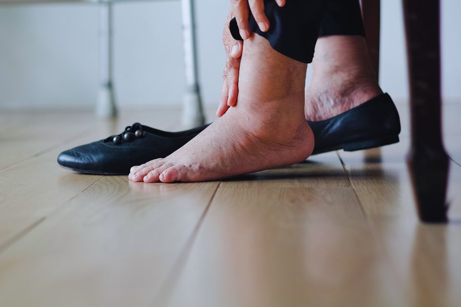 Welt-Thrombose-Tag: Thrombose verstehen