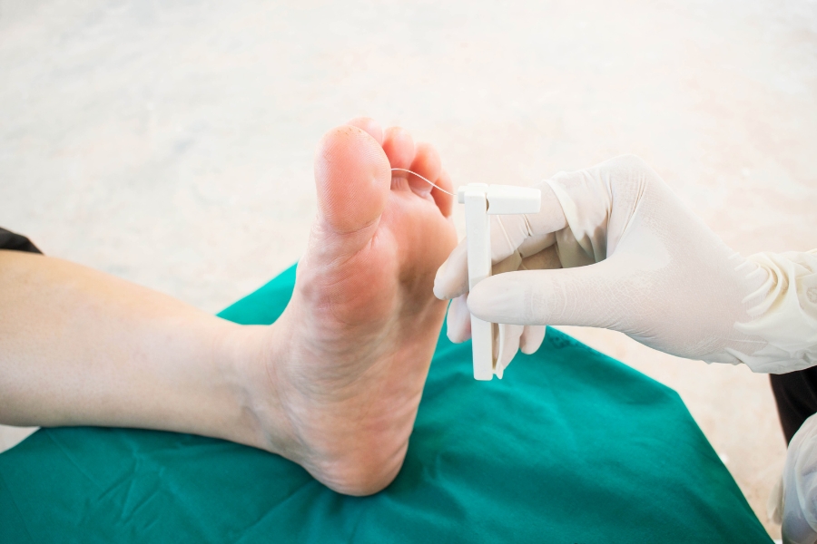 Diabetischer Fuß:Testung mit Monofilament
